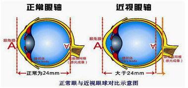 成人防近视方法视频